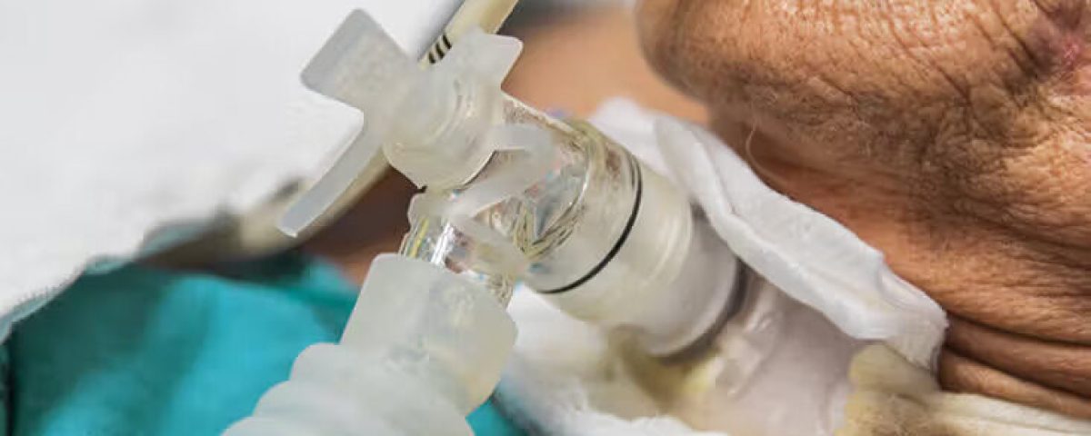 senior-female-tracheostomy-732-549-feature-thumb-732x549